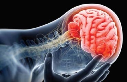 Brain Injury Physiotherapy in Bhopal